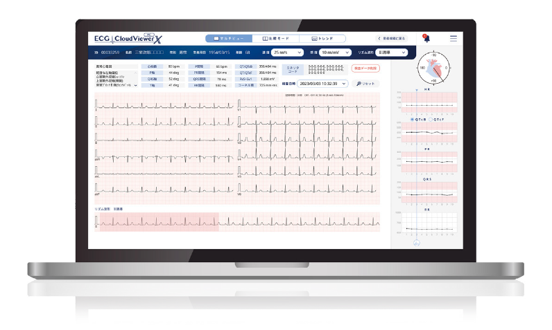 ＰＣーＥＣＧクラウドビューア